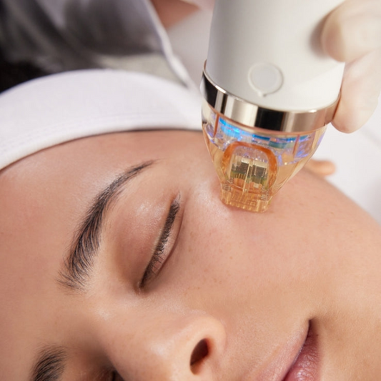 Microneedling