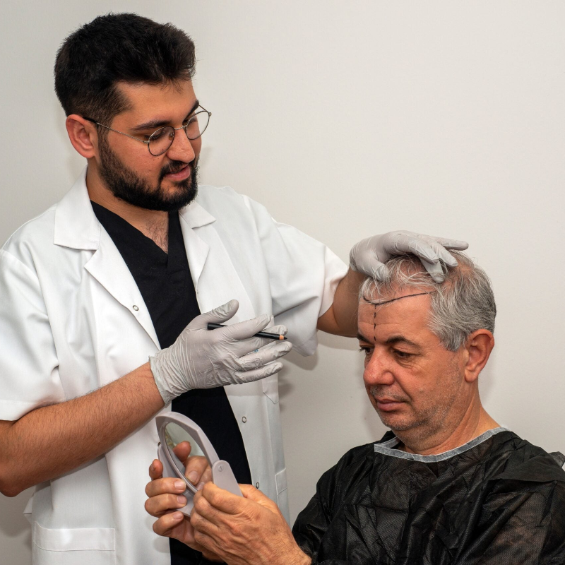 Hair Transplant